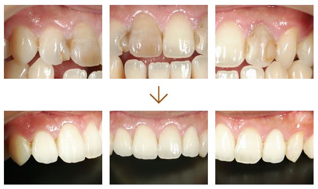 審美歯科・ホワイトニング 20代 男性