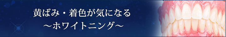 黄ばみ・着色が気になる　～ホワイトニング～