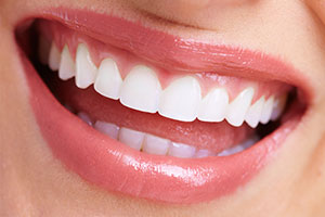歯並びをきれいに整える矯正治療